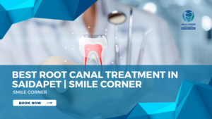 Root Canal Treatment in Kolathur