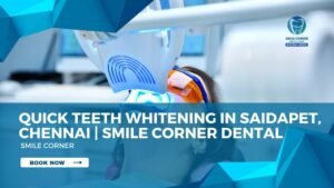 Teeth Whitening in Saidapet