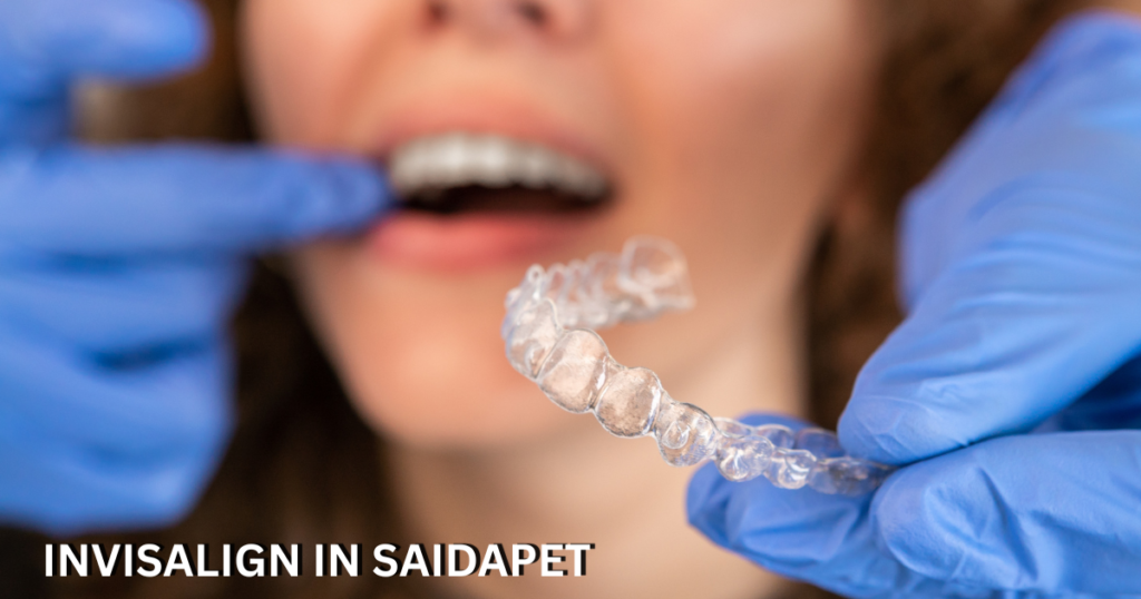 invisalign in saidapet