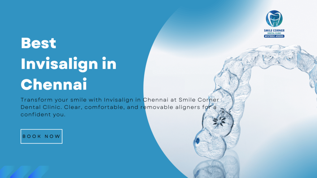Best invisalign in chennai