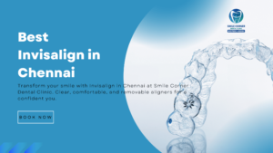 Best invisalign in chennai