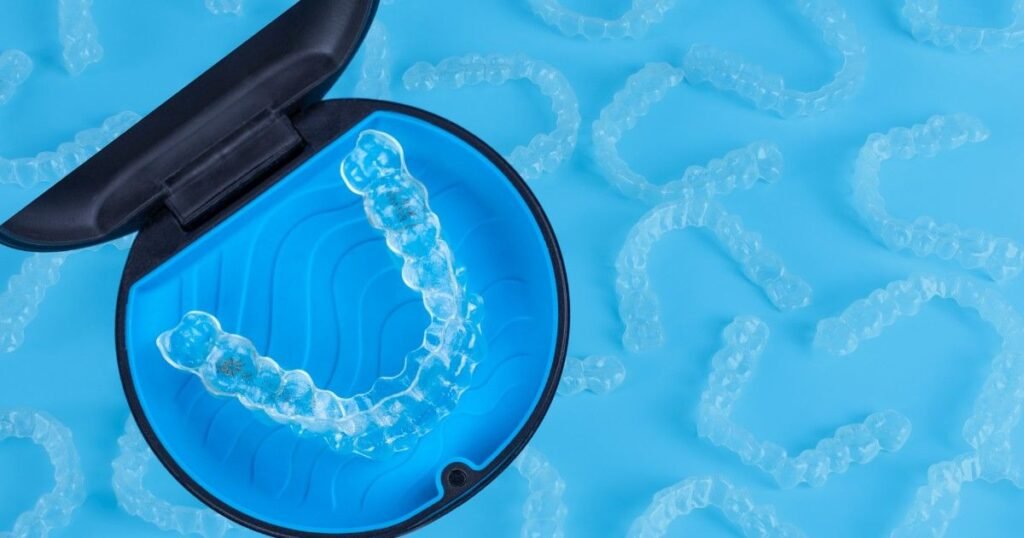 Invisalign in T.Nagar