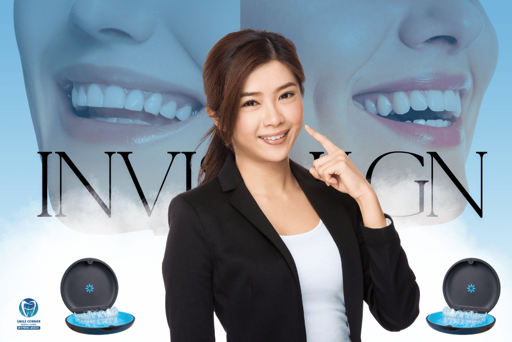 Invisalign Treatment in Chennai | Invisalign tips | Smile Corner Saidapet