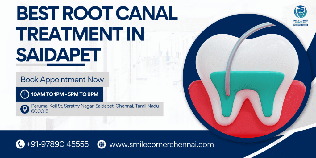 Best Root Canal Treatment in Saidapet, Chennai: Painless Dental Solutions at Smile Corner