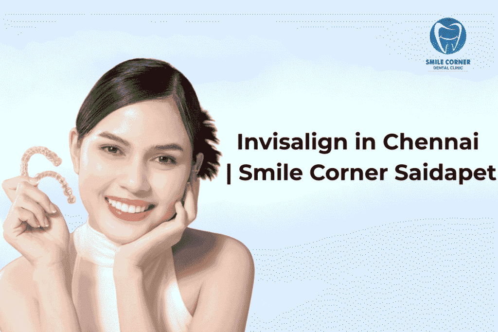 Invisalign in Chennai