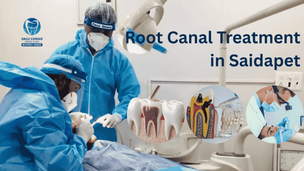 Root Canal Treatment in Saidapet