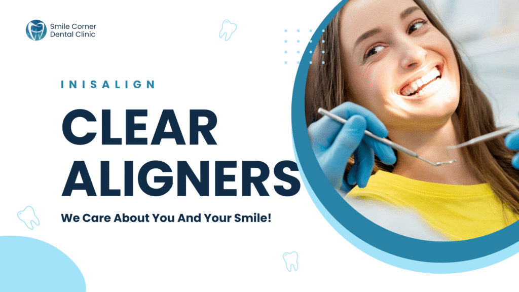 Clear aligners in chennai