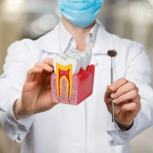 Root Canal treatment in saidapet