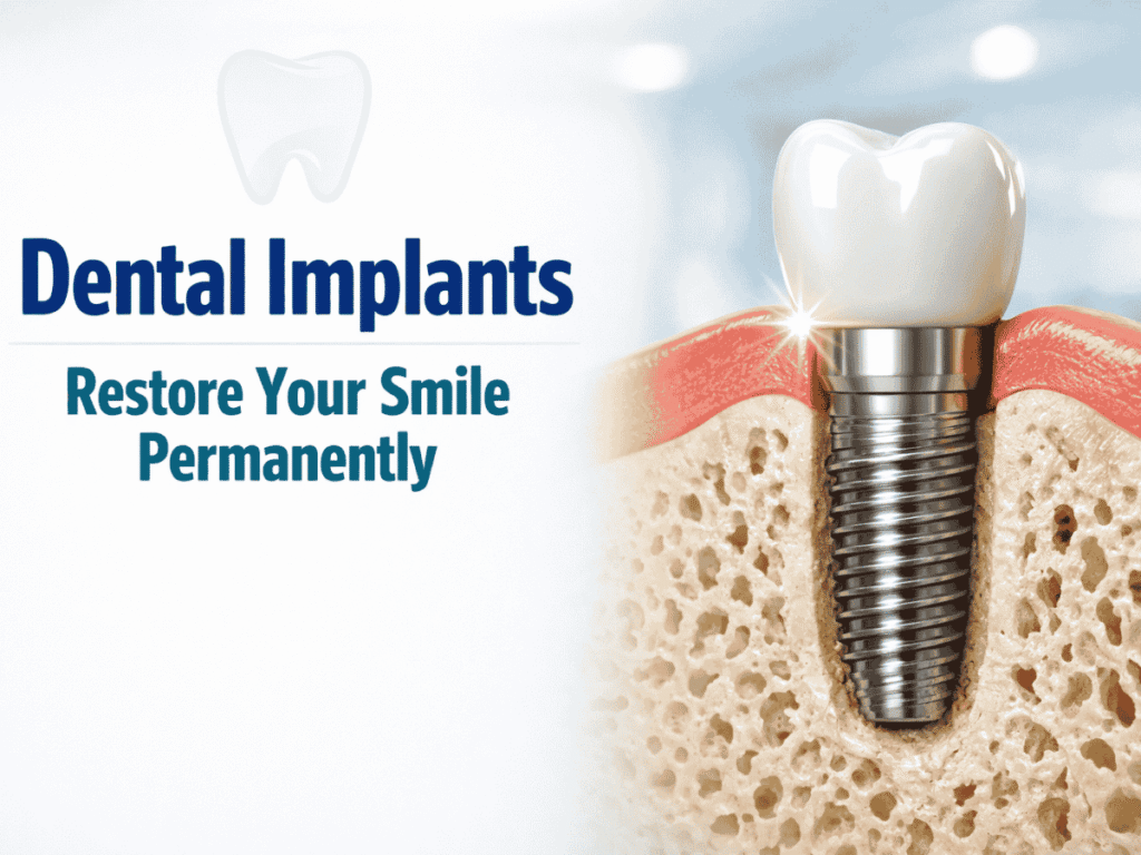 Dental Implants in Saidapet