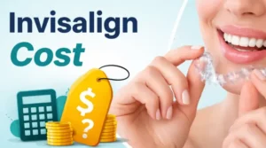 Invisalign Cost in Chennai
