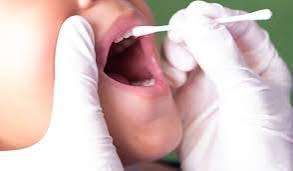 Fluoride Therapy in Chennai-smilecorner