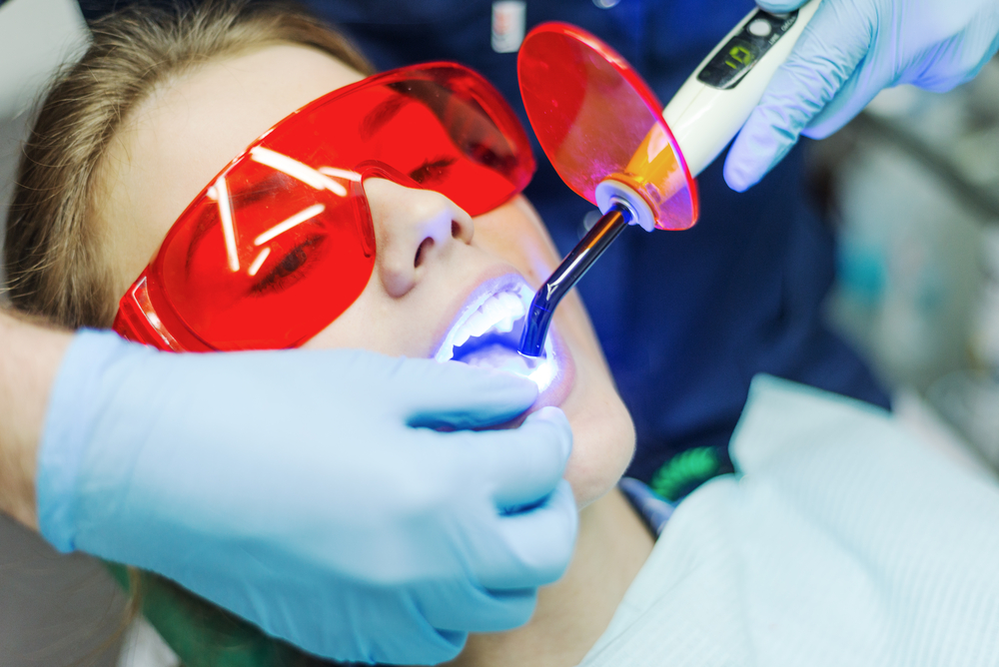 Laser Dentistry in chennai