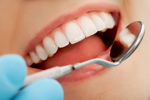 fluoride-therapy-smilecorner-clinic