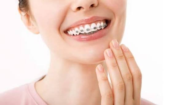 orthodontics-3