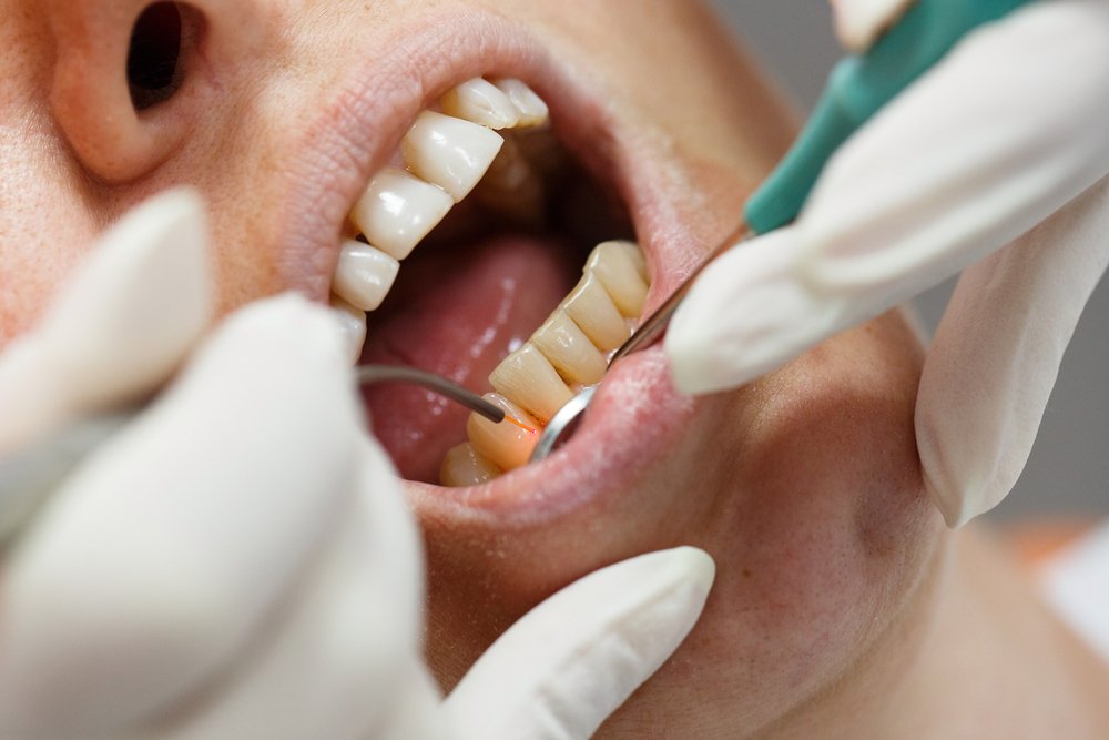 safest laser dentistry